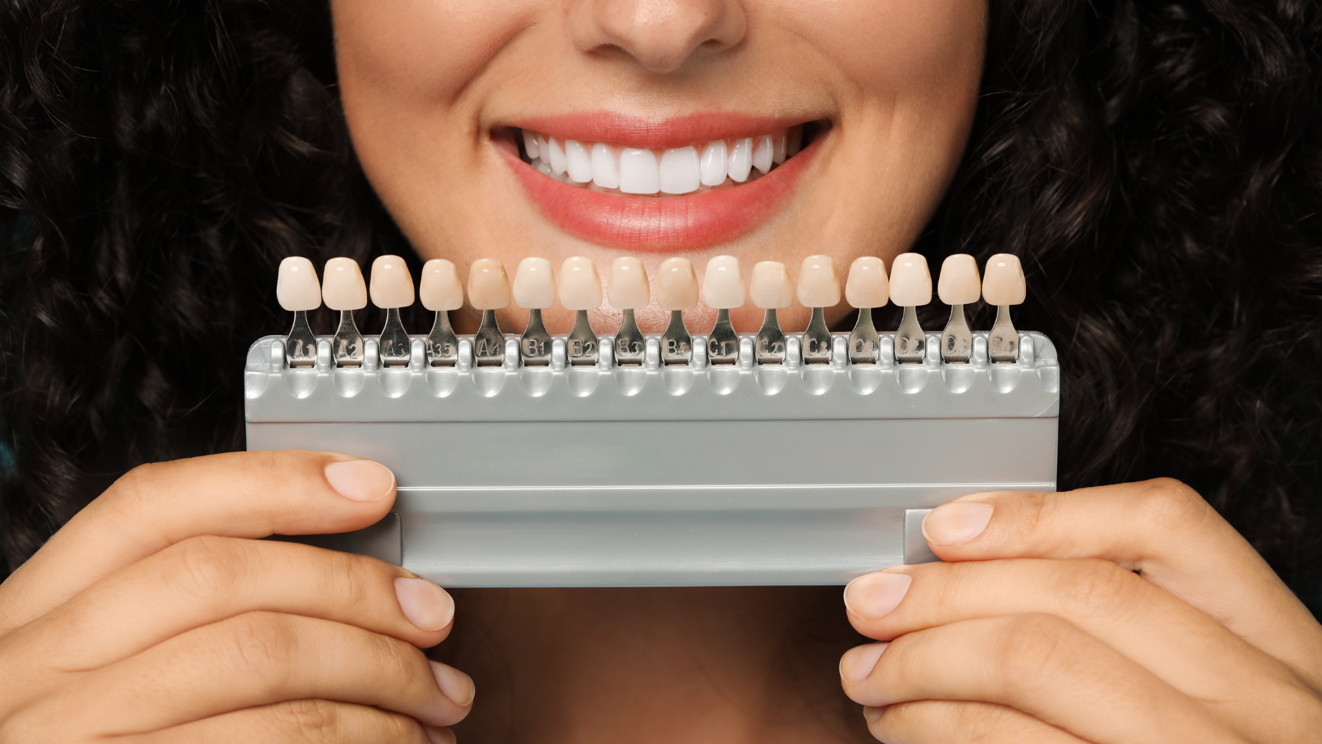 Porcelain Veneers in Chembur