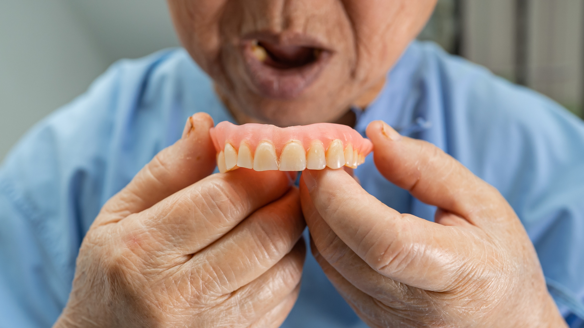 Dentures in Chembur fitting at Loop Dental