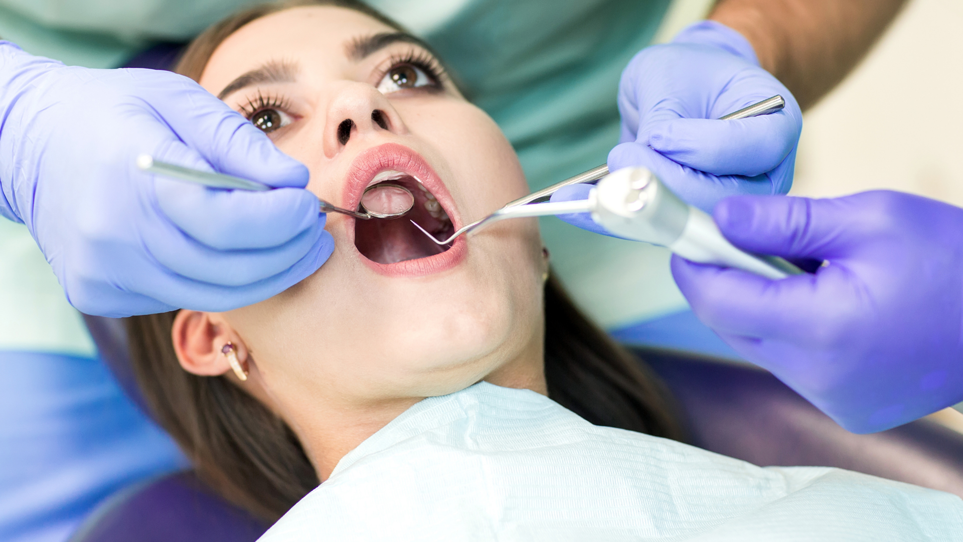 Teeth cleaning in Chembur session at Loop Dental