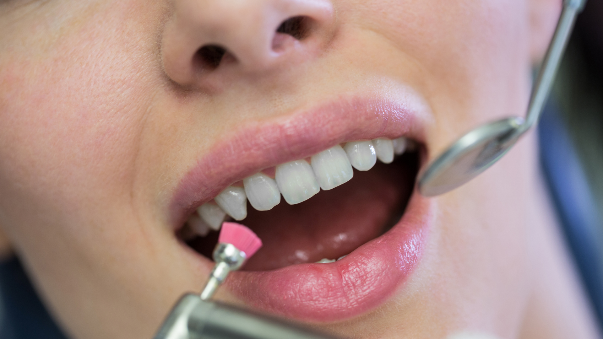 Range of dental services in Chembur displayed at clinic